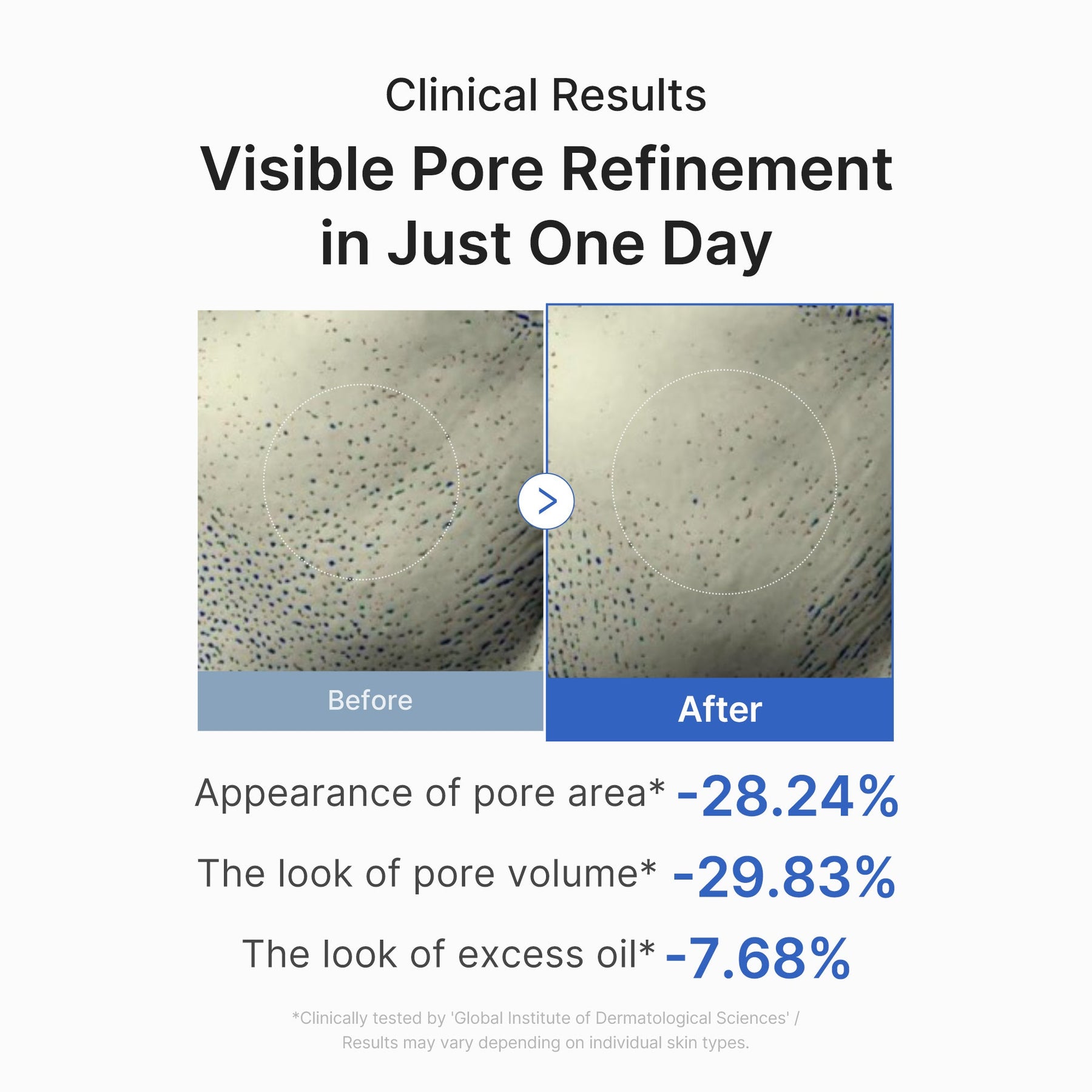 Pore Care Duo